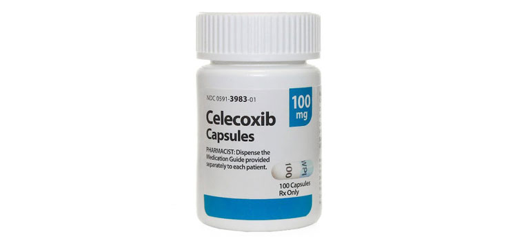 order cheaper celecoxib online in Vermont