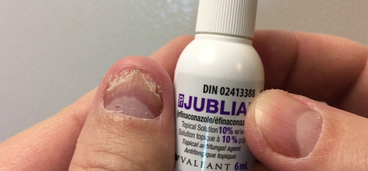 order cheaper jublia online in Vermont